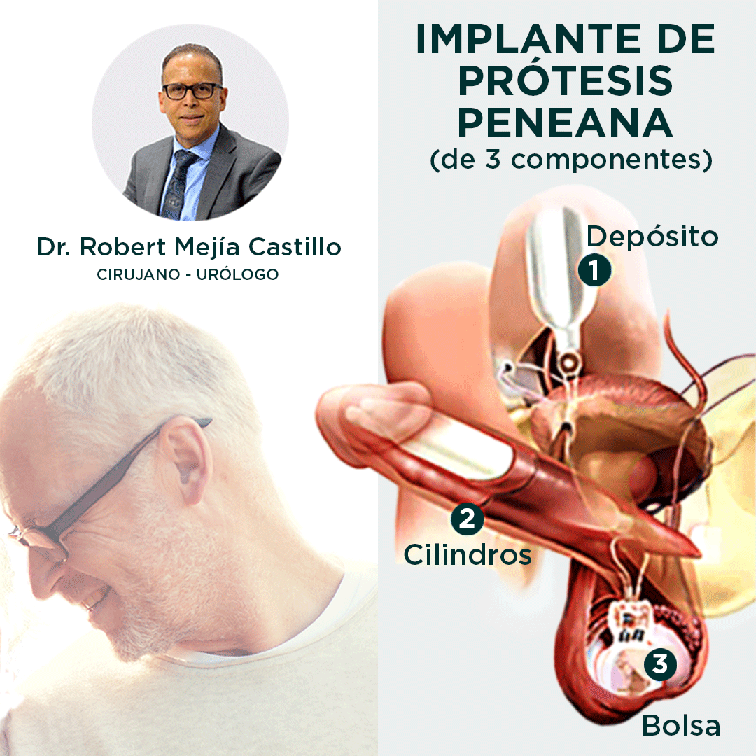 Implante de prótesis peneana de 3 componentes | Dr. Robert Mejia Castillo, urólogo
